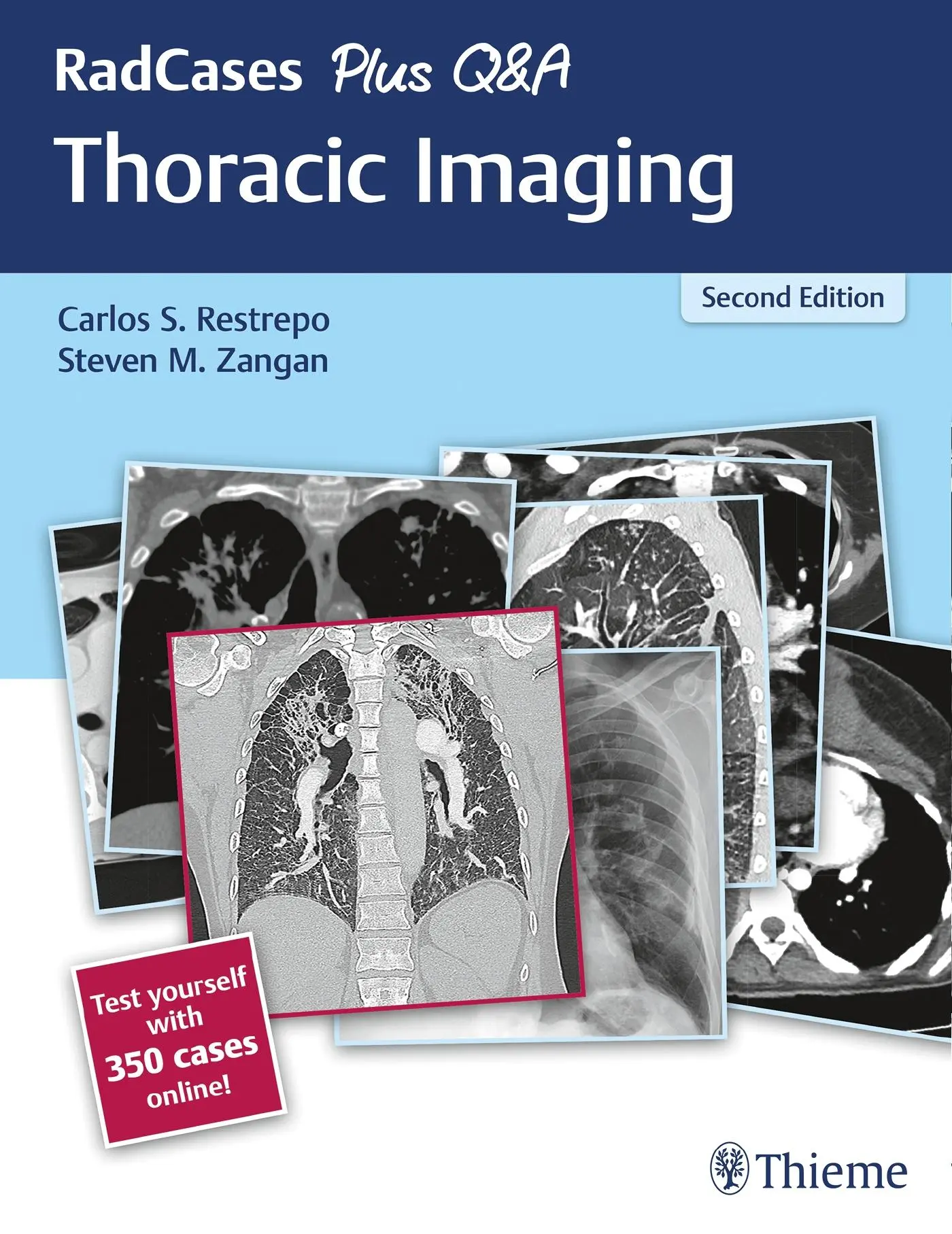 Cover: 9781626238145 | Radcases Plus Q&amp;A Thoracic Imaging | Carlos S Restrepo (u. a.) | Buch