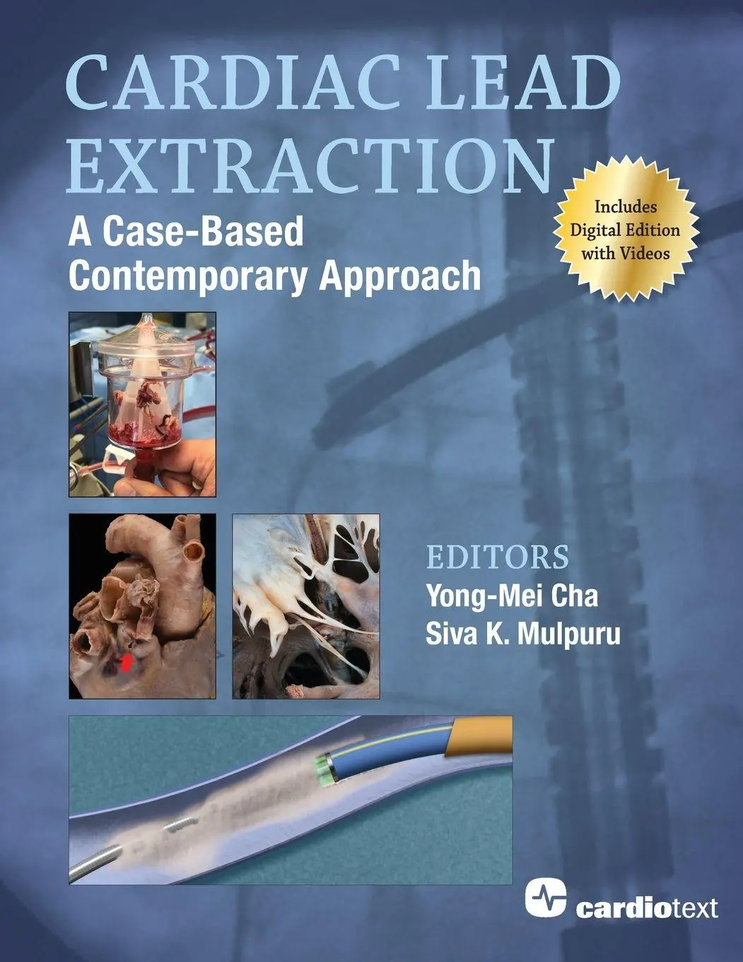 Cover: 9781942909545 | Cardiac Lead Extraction | A Case-Based Contemporary Approach | Buch