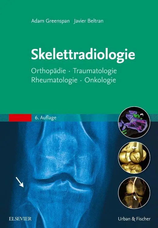 Cover: 9783437230646 | Skelettradiologie | Adam Greenspan | Buch | XVIII | Deutsch | 2017