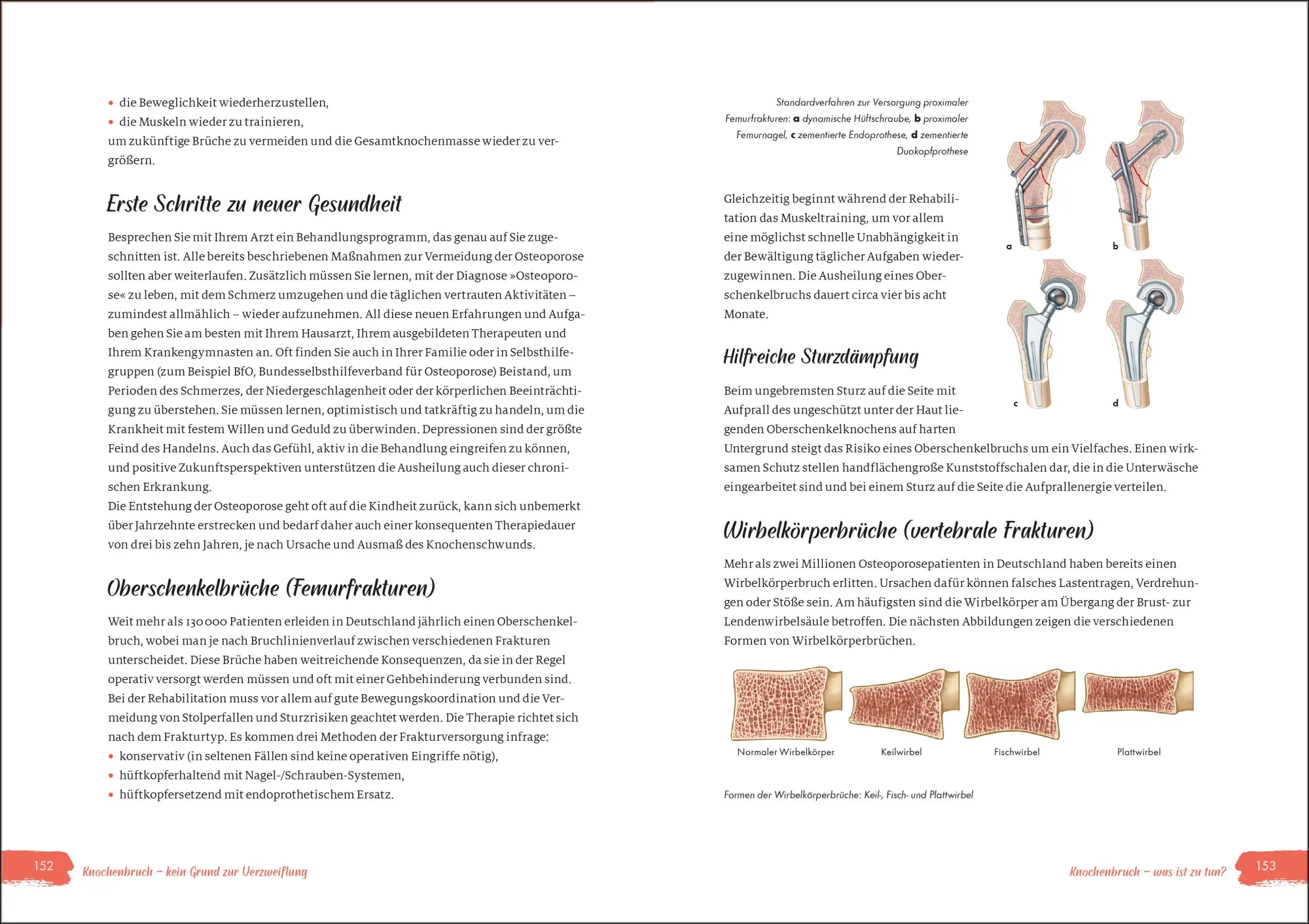 Bild: 9783517100746 | Power für die Knochen - Osteoporose vorbeugen, diagnostizieren,...