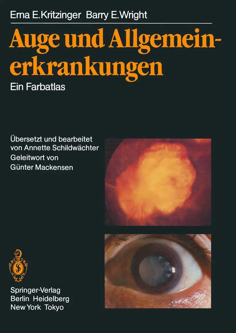 Cover: 9783642932946 | Auge und Allgemeinerkrankungen | Ein Farbatlas | Kritzinger (u. a.)