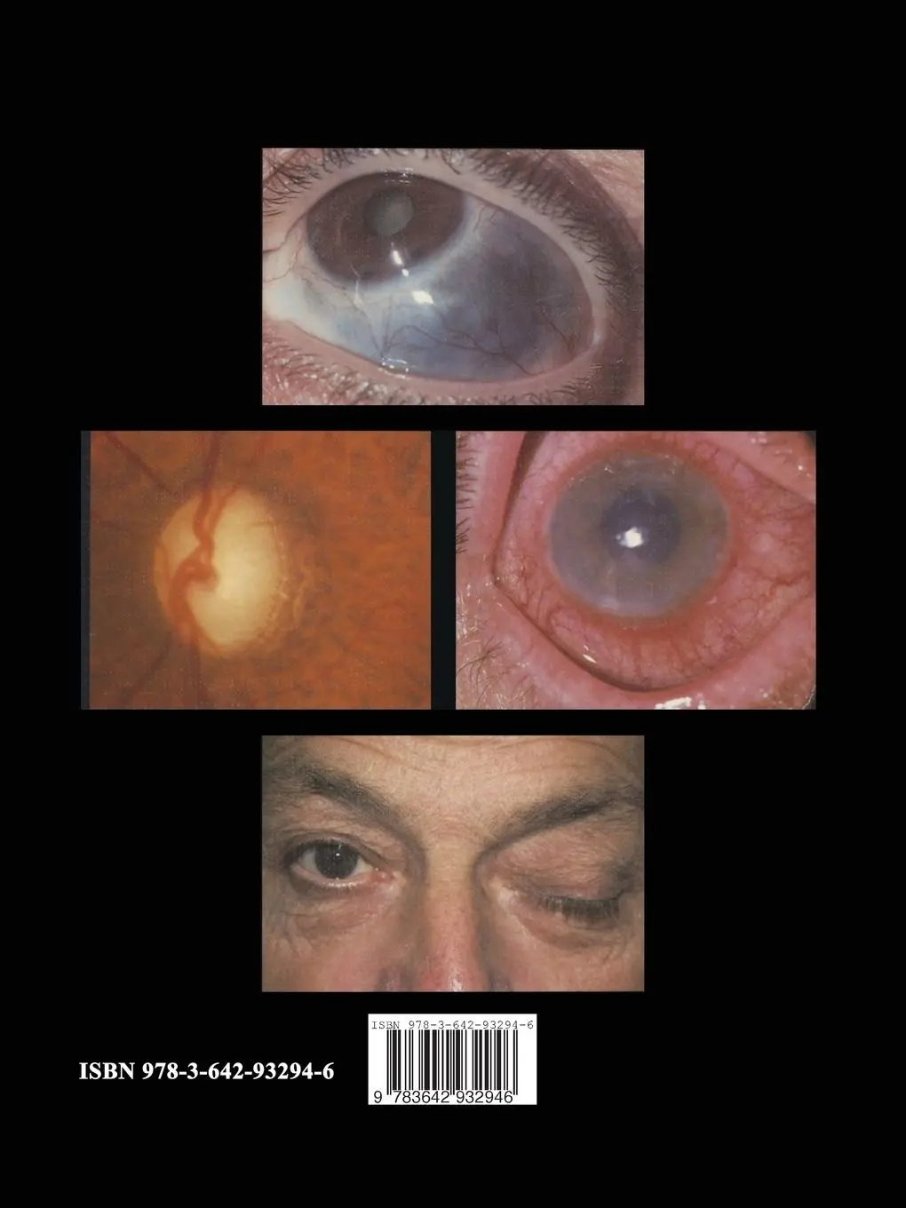 Rückseite: 9783642932946 | Auge und Allgemeinerkrankungen | Ein Farbatlas | Kritzinger (u. a.)