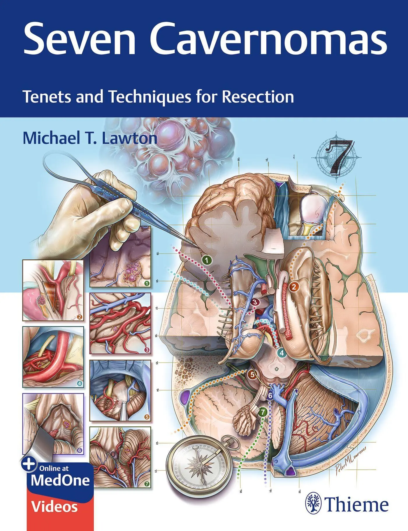Cover: 9781684204946 | Seven Cavernomas | Tenets and Techniques for Resection | Lawton | Buch