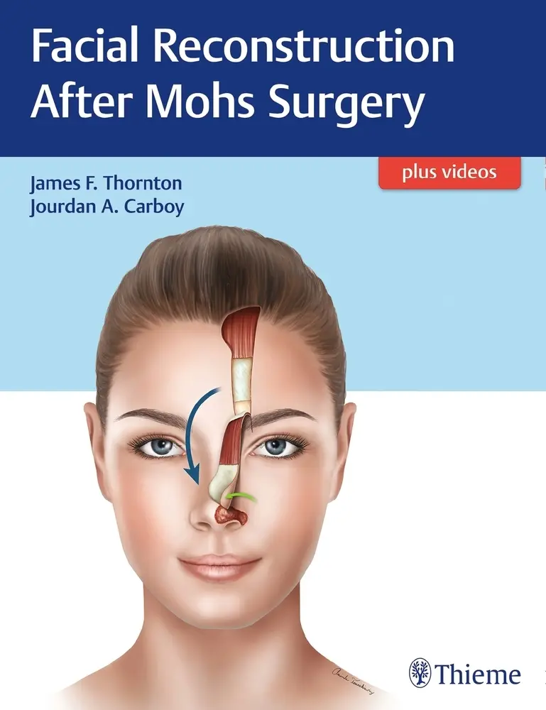 Cover: 9781626237346 | Facial Reconstruction After Mohs Surgery | Plus Videos | Bundle | 2018