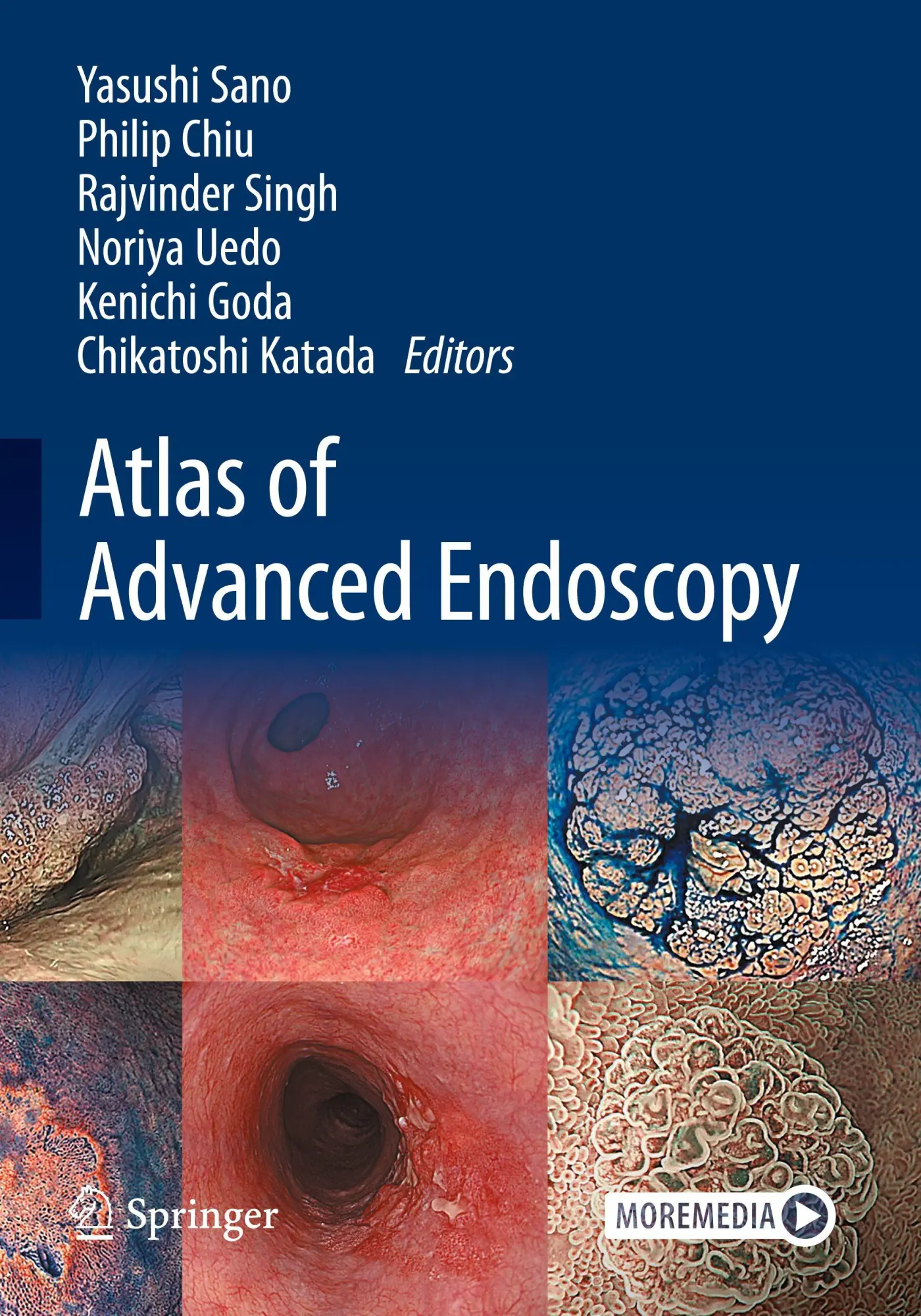 Cover: 9789819727346 | Atlas of Advanced Endoscopy | Yasushi Sano (u. a.) | Taschenbuch