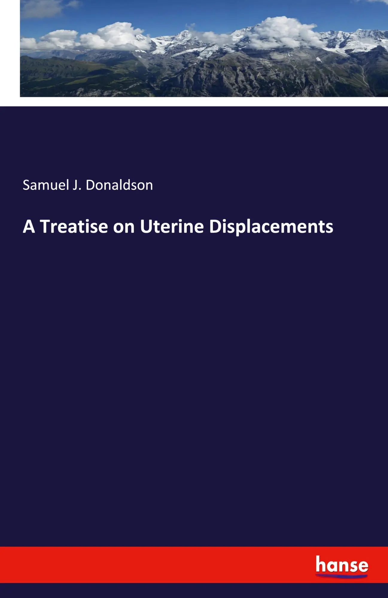 A Treatise on Uterine Displacements - Samuel J Donaldson Kartoniert (TB)