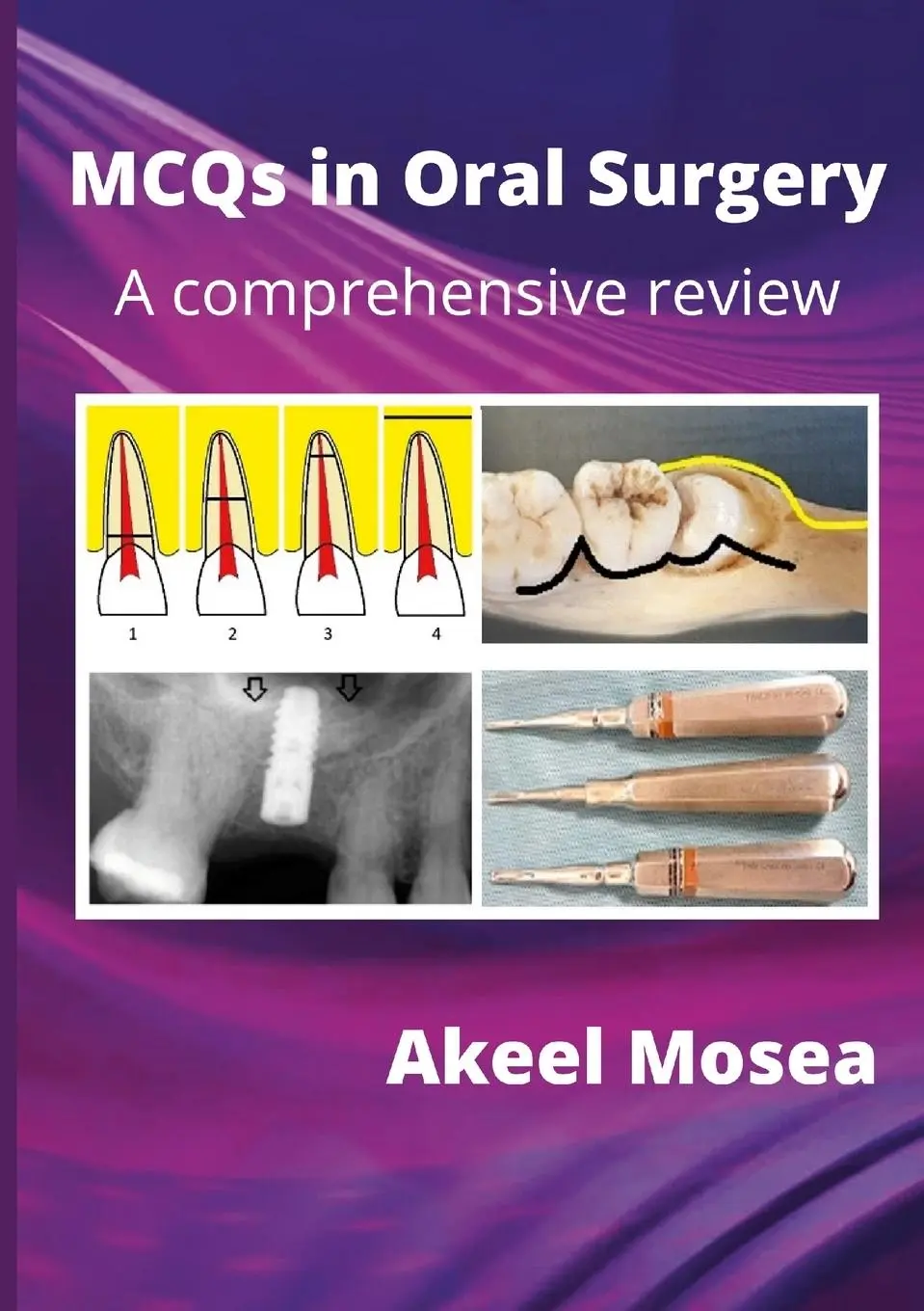 Cover: 9781257641147 | MCQs in Oral Surgery | A comprehensive review | Akeel Mosea | Buch