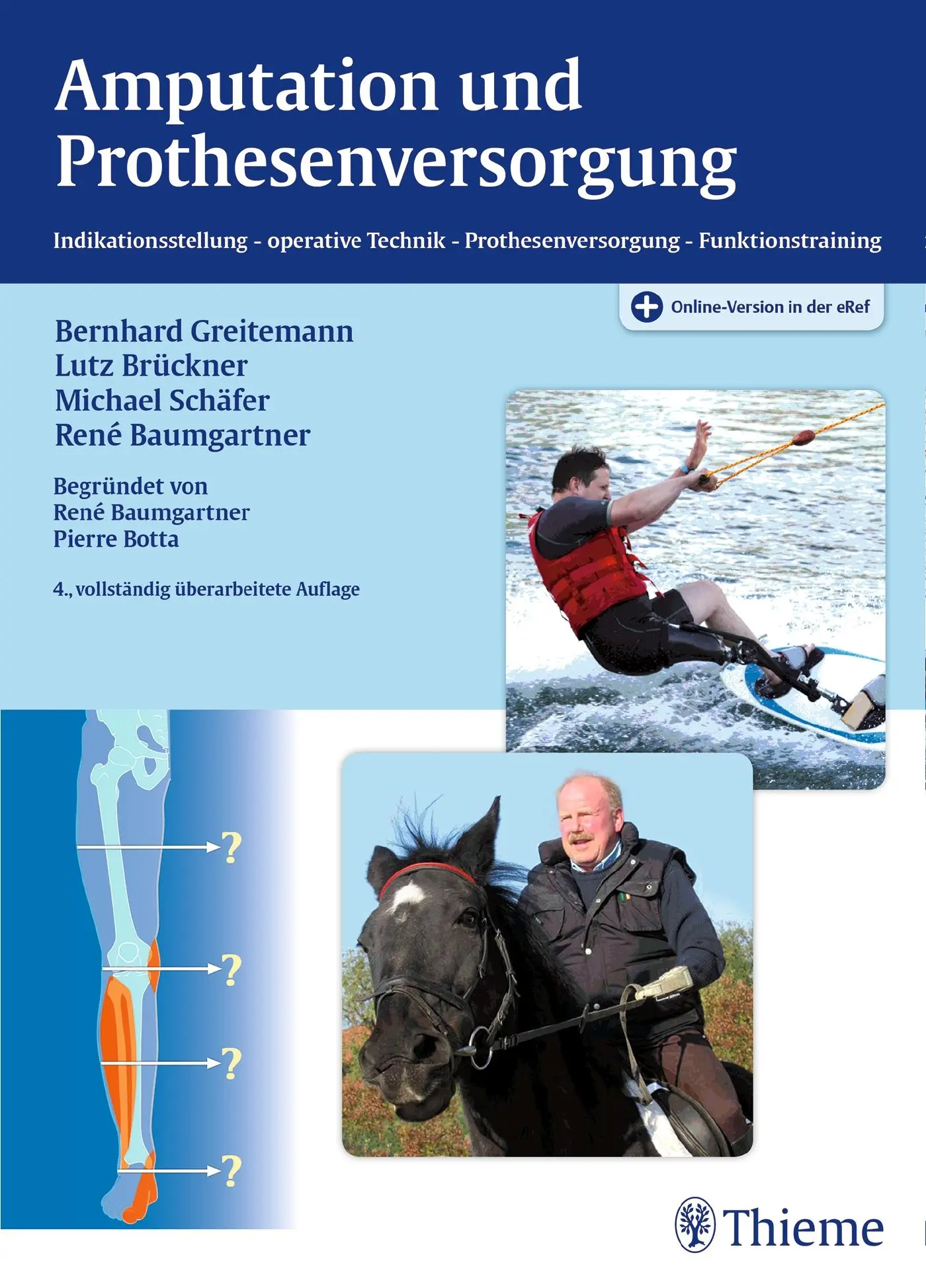 Cover: 9783131361547 | Amputation und Prothesenversorgung | Lutz Brückner (u. a.) | Bundle