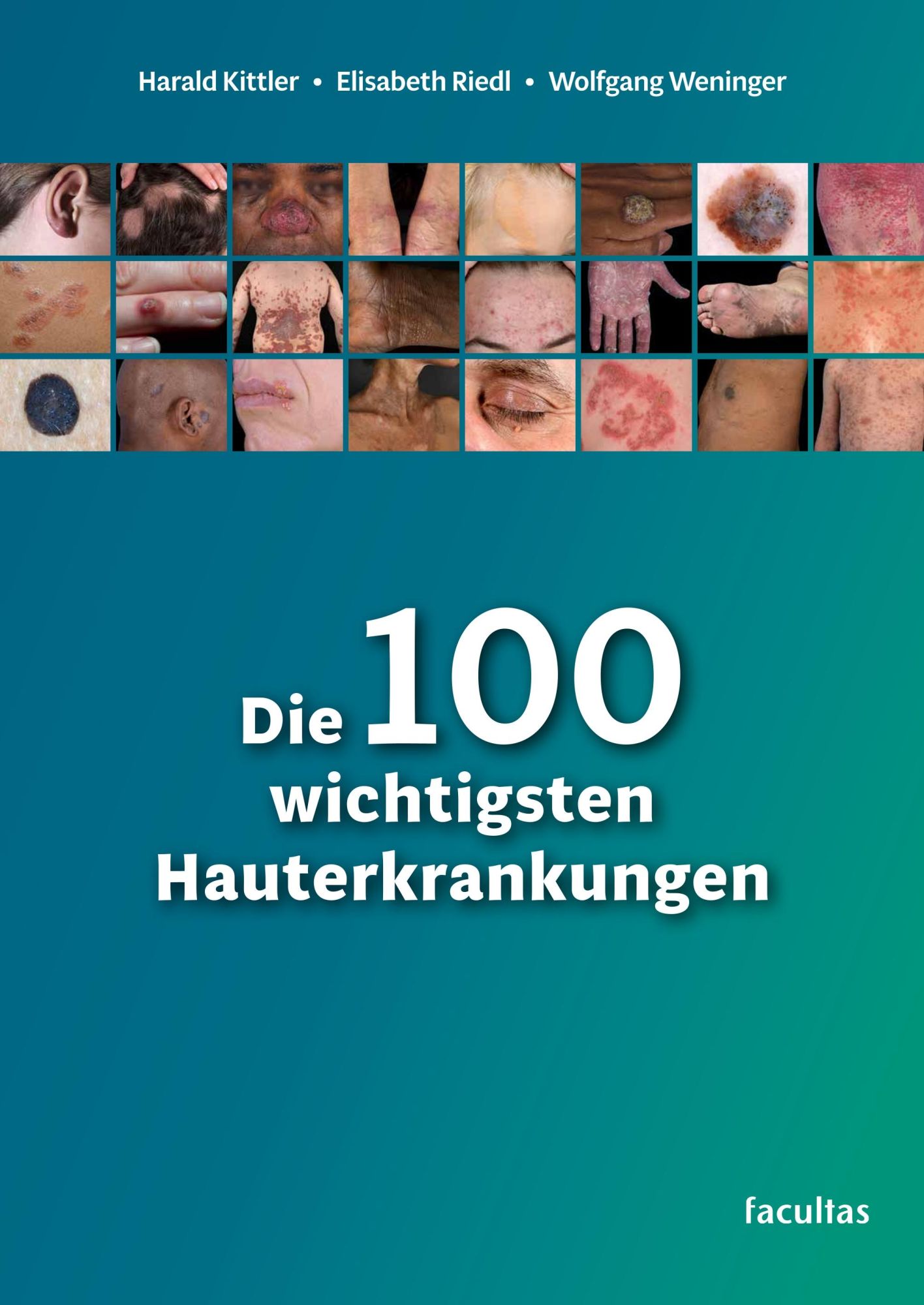 Cover: 9783708923147 | Die 100 wichtigsten Hauterkrankungen | Harald Kittler (u. a.) | Buch