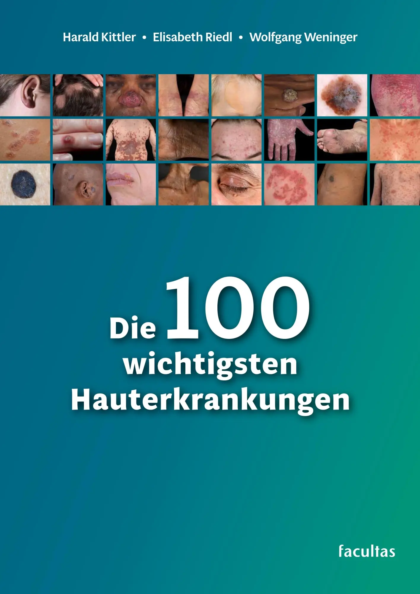 Cover: 9783708923147 | Die 100 wichtigsten Hauterkrankungen | Harald Kittler (u. a.) | Buch