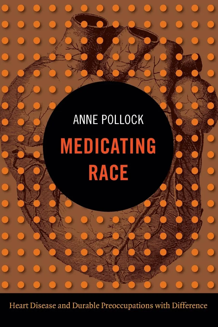 Cover: 9780822353447 | Medicating Race | Anne Pollock | Taschenbuch | Englisch | 2012