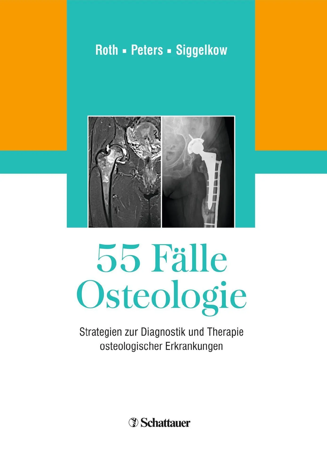 Cover: 9783132425347 | 55 Fälle Osteologie | Andreas Roth | Buch | 313 S. | Deutsch | 2018