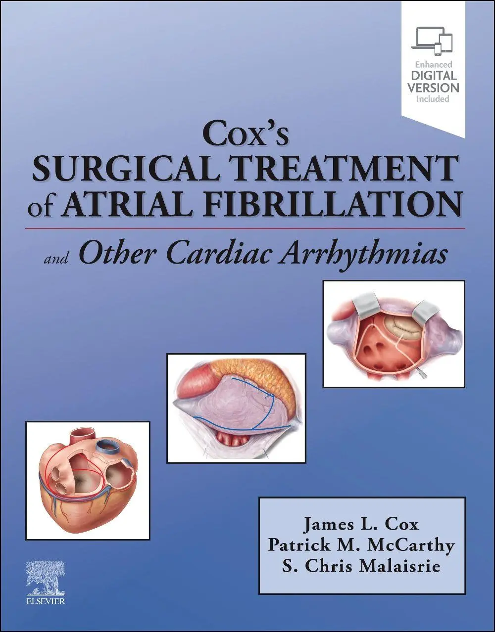 Cover: 9780443285547 | Cox's Surgical Treatment of Atrial Fibrillation | James L. Cox (u. a.)
