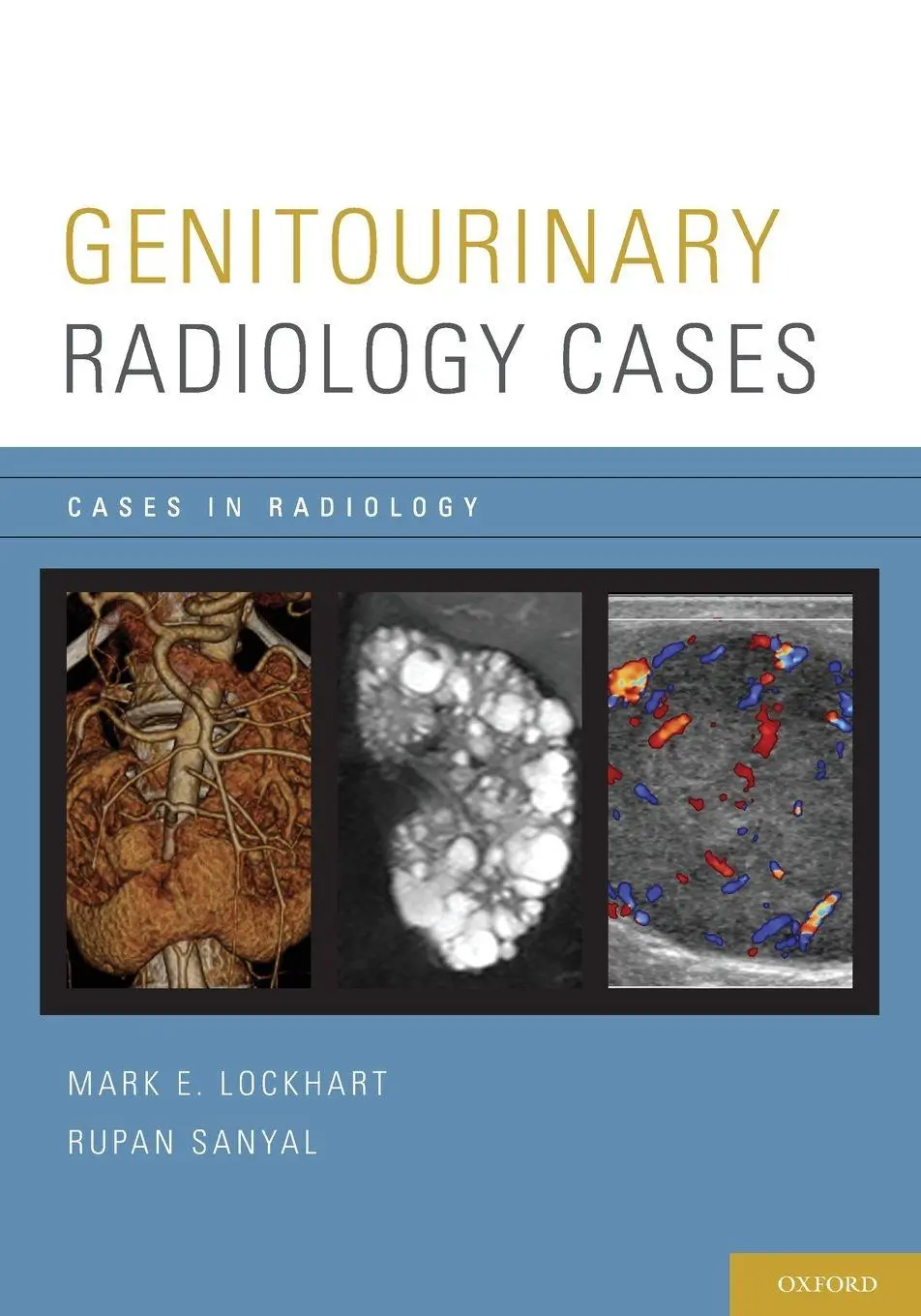 Cover: 9780199975747 | GENITOURINARY RADIOLOGY CASES CASRAD P | Lockhart | Taschenbuch | 2015