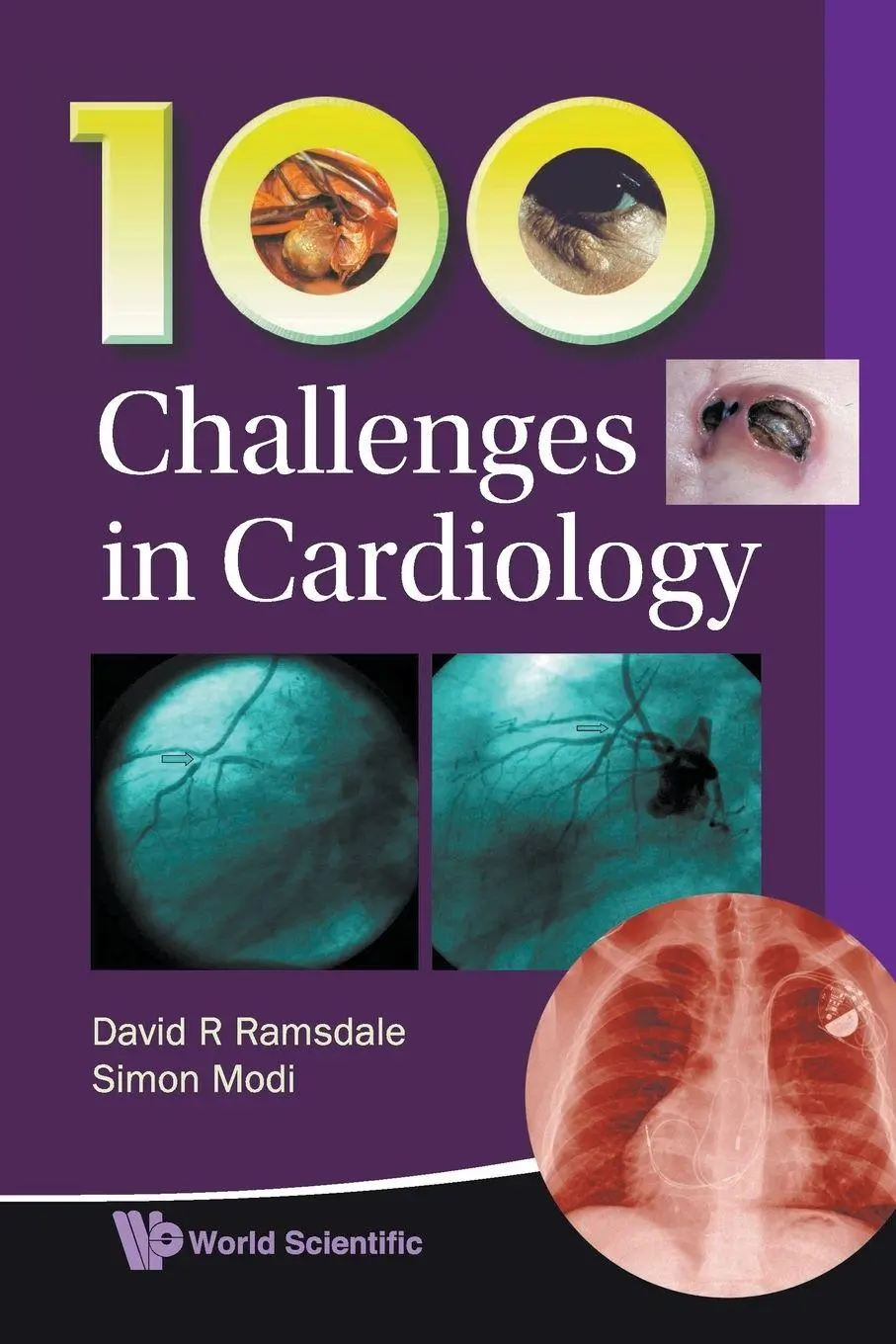 Cover: 9789814307147 | 100 CHALLENGES IN CARDIOLOGY | Ramsdale David R | Taschenbuch | 2010