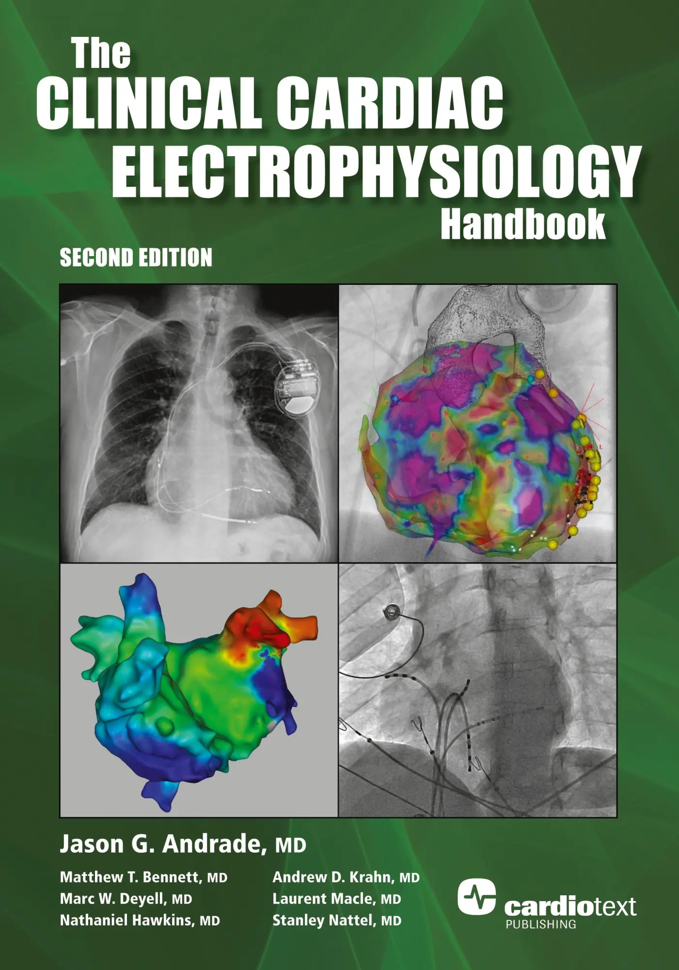Cover: 9781942909347 | The Clinical Cardiac Electrophysiology Handbook, Second Edition | Buch