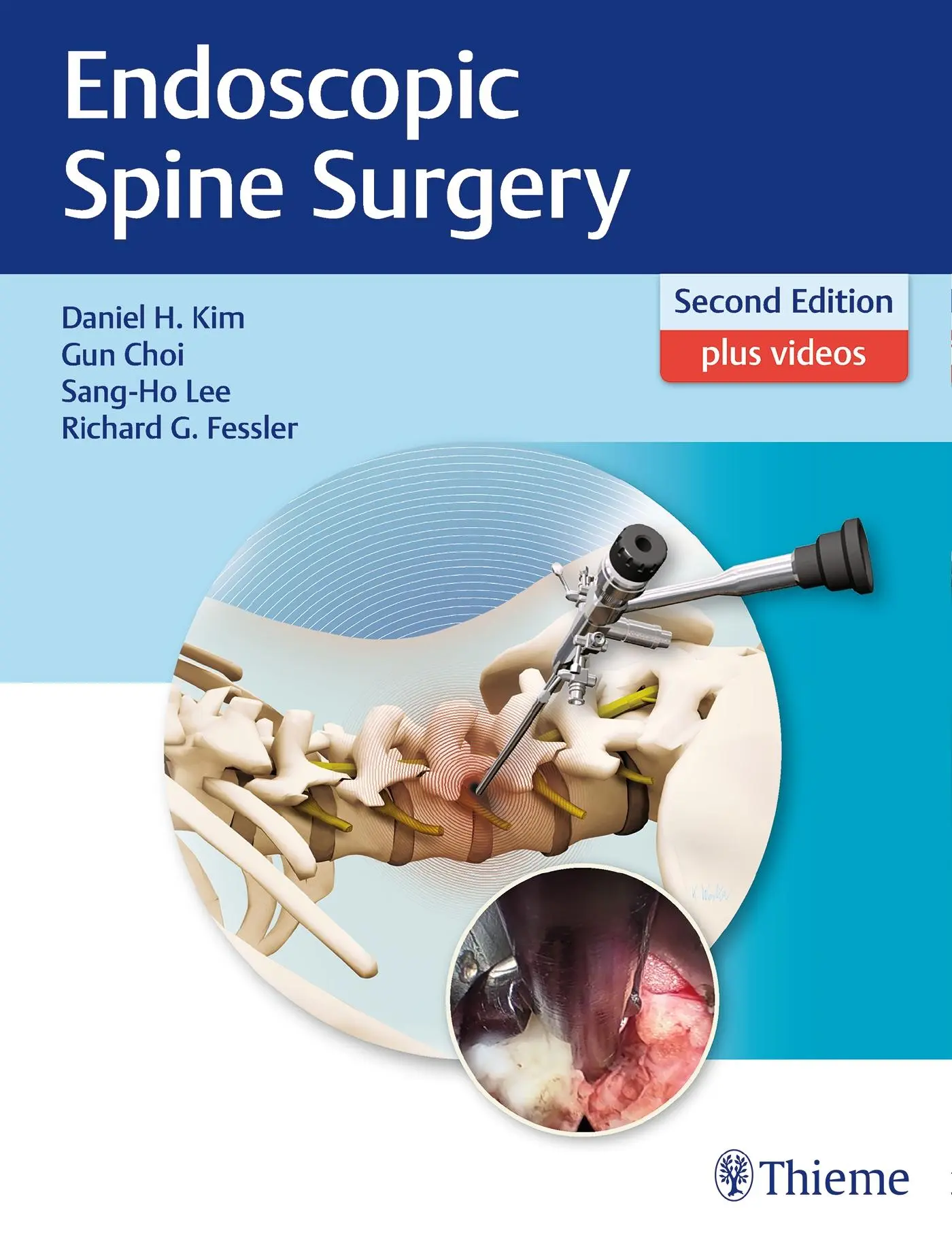 Cover: 9781626232648 | Endoscopic Spine Surgery | Daniel H Kim (u. a.) | Buch | 380 S. | 2018