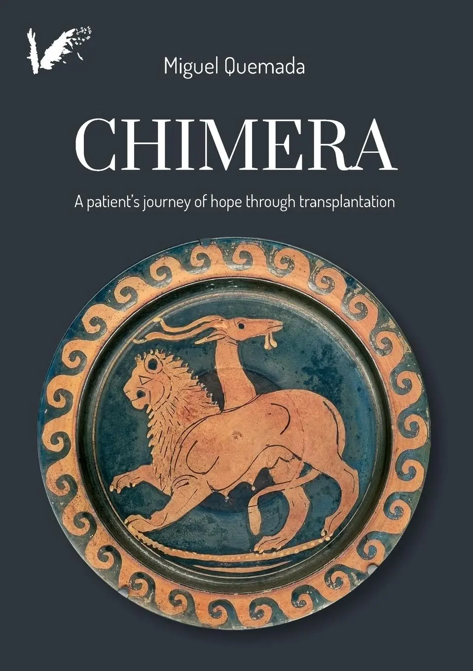 Cover: 9791399003048 | Chimera. A patient's journey of hope through transplantation | Quemada