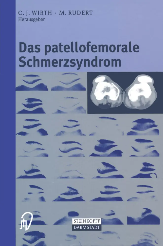 Cover: 9783642633348 | Das patellofemorale Schmerzsyndrom | C. J. Wirth (u. a.) | Taschenbuch