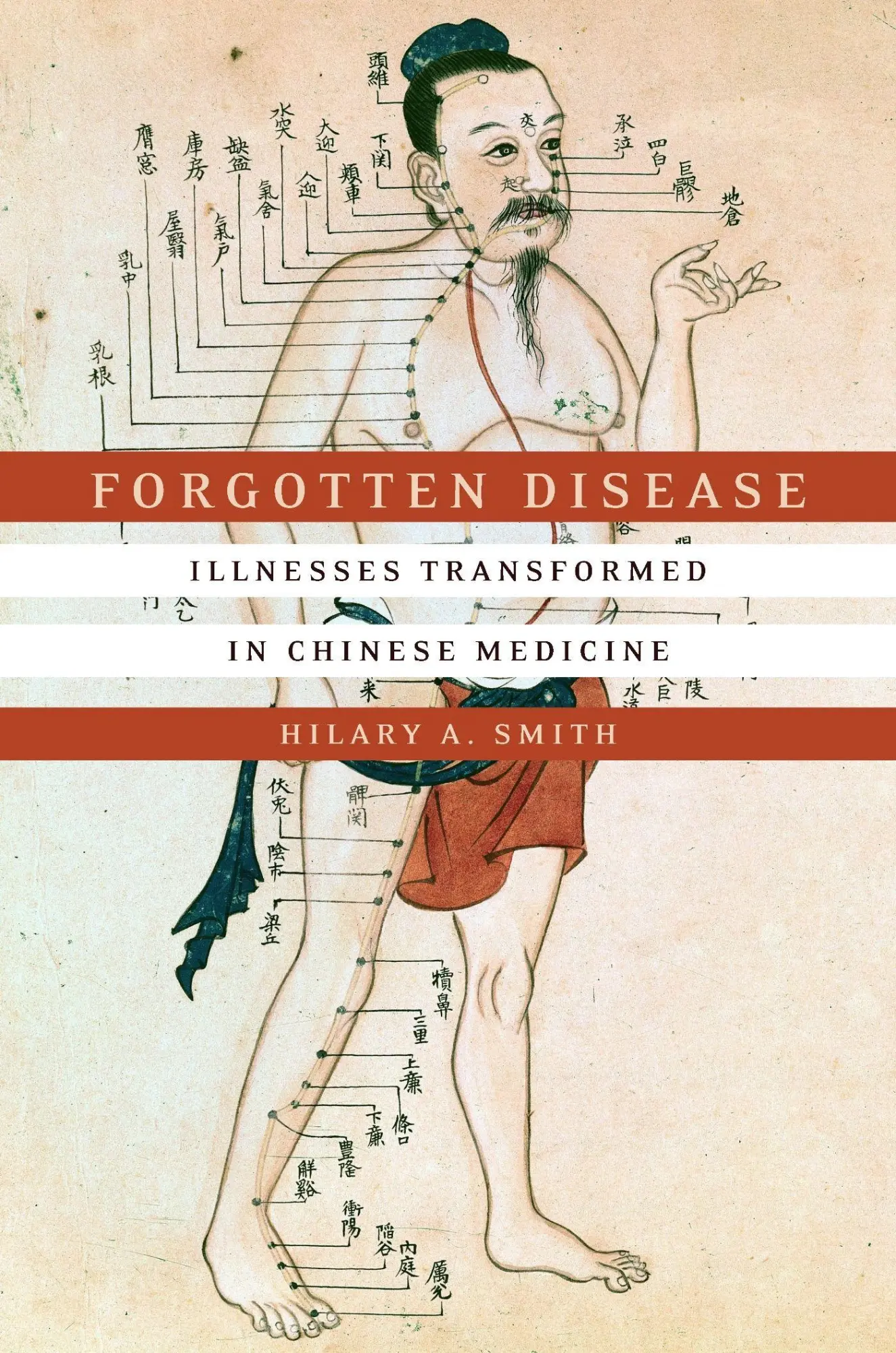 Cover: 9781503603448 | Forgotten Disease | Illnesses Transformed in Chinese Medicine | Smith