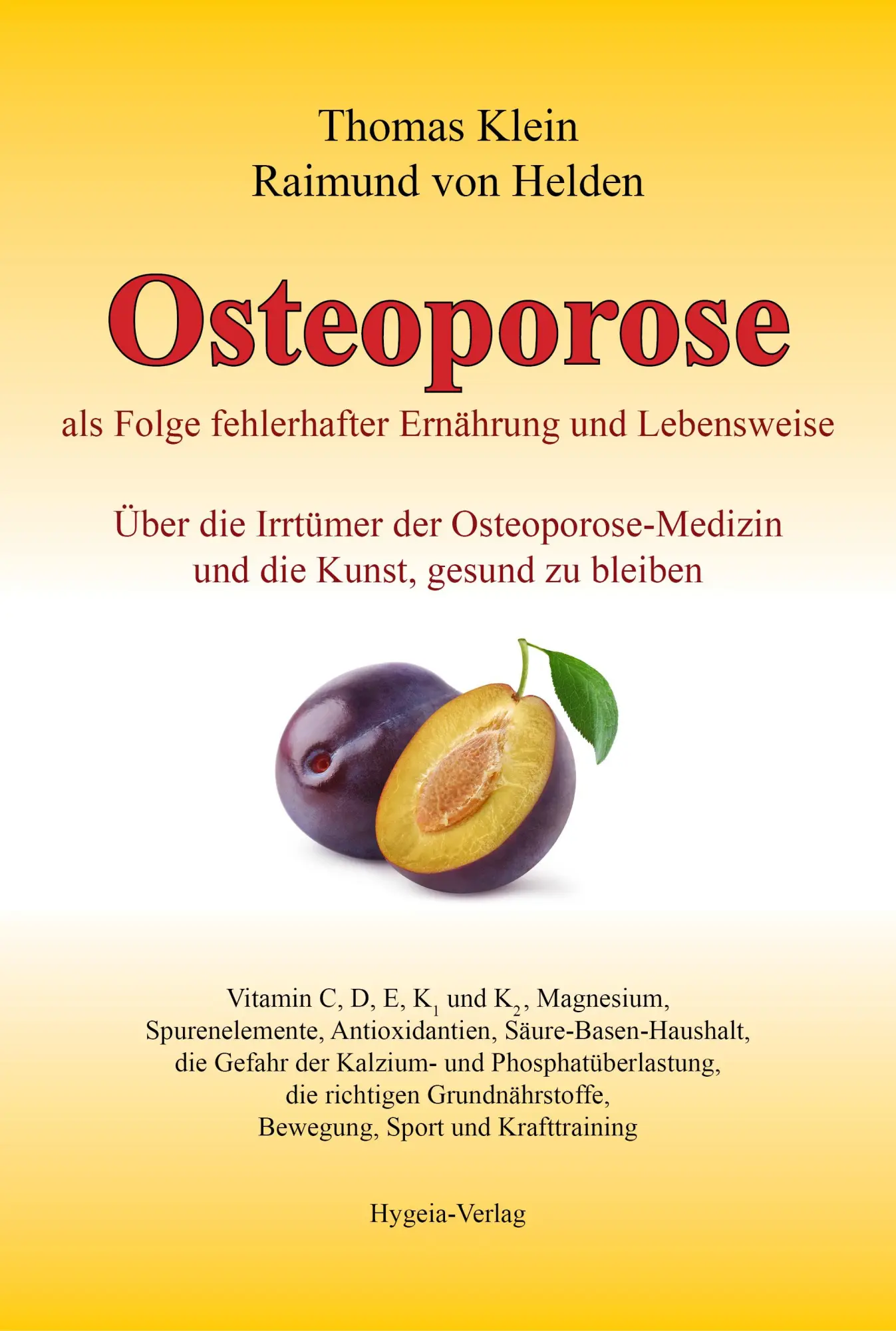 Cover: 9783939865148 | Osteoporose | Thomas Klein (u. a.) | Buch | 775 S. | Deutsch | 2015