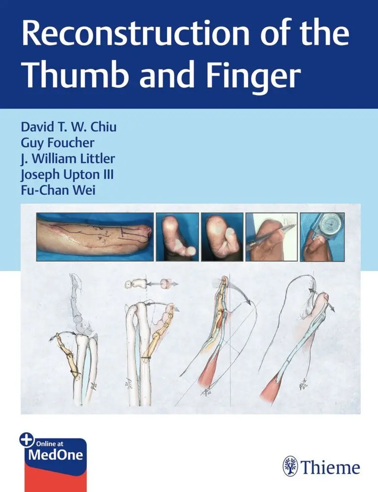 Cover: 9781626235748 | Reconstruction of the Thumb and Finger | David Chiu (u. a.) | Bundle