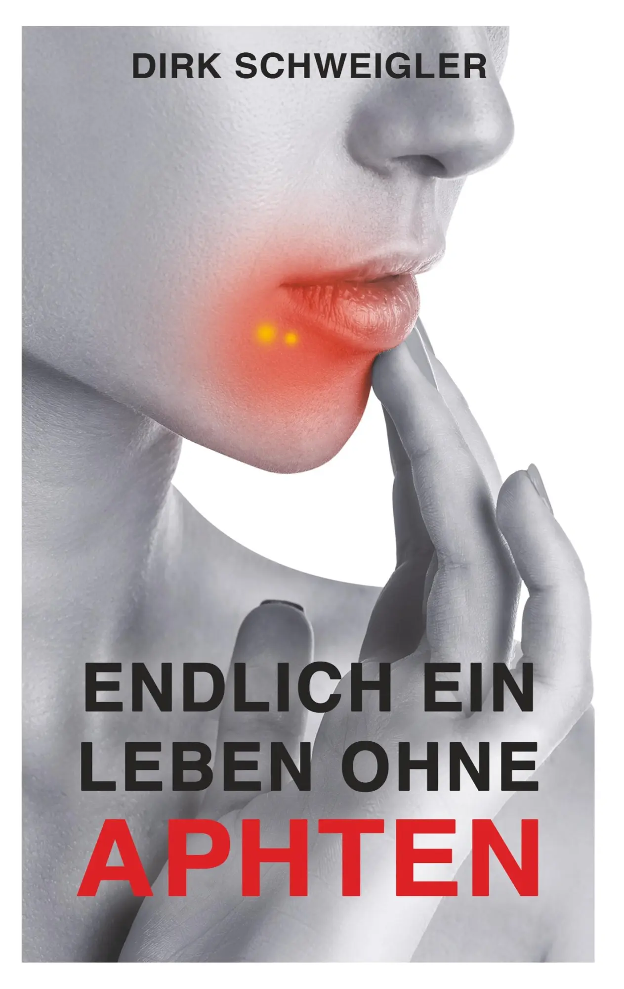 Cover: 9783748178248 | Endlich ein Leben ohne Aphten | Dirk Schweigler | Taschenbuch | 84 S.