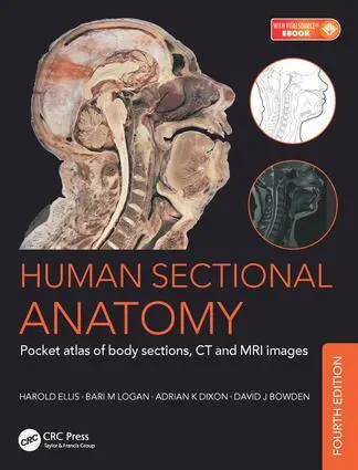 Cover: 9781498708548 | Human Sectional Anatomy | Adrian Kendal Dixon (u. a.) | Taschenbuch
