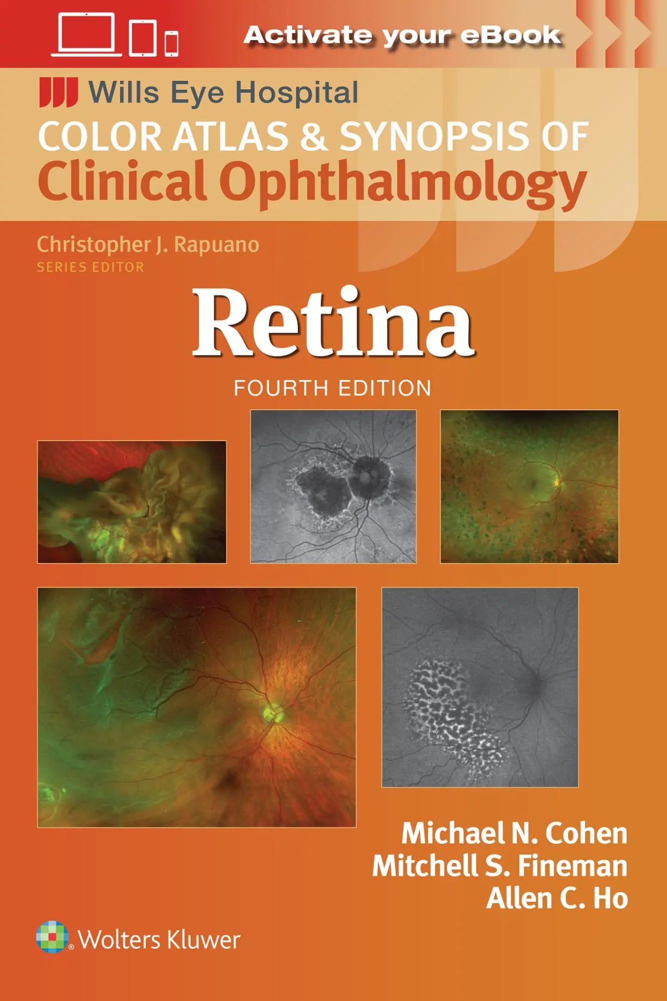 Cover: 9781975215149 | Retina | Mitchell S. Fineman | Taschenbuch | Englisch | 2024