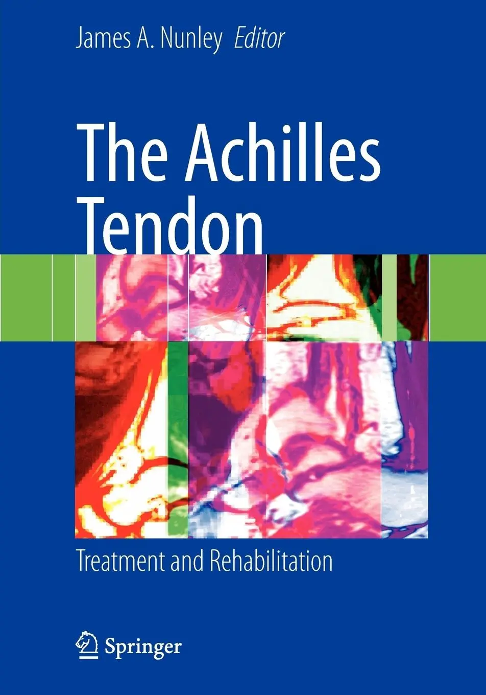 Cover: 9781441927149 | The Achilles Tendon | Treatment and Rehabilitation | James A Nunley