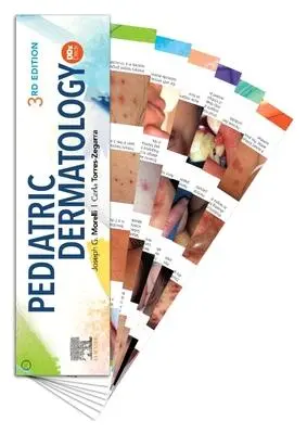 Cover: 9780323680950 | Pediatric Dermatology DDX Deck | Joseph G Morelli (u. a.) | Box | 2020