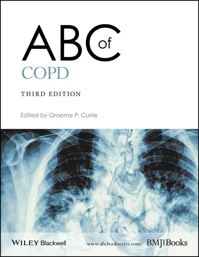Cover: 9781119212850 | ABC of Copd | Graeme P Currie | Taschenbuch | 136 S. | Englisch | 2017