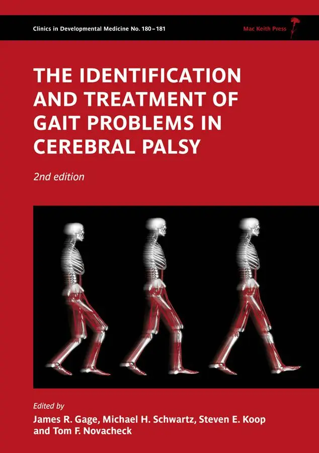 Cover: 9781898683650 | The Identification and Treatment of Gait Problems in Cerebral Palsy