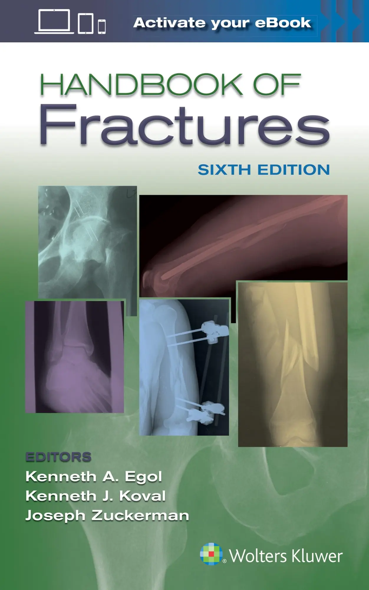 Cover: 9781496384850 | Handbook of Fractures | Kenneth Egol | Taschenbuch | Englisch | 2019