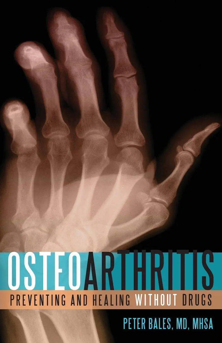 Cover: 9781591026150 | Osteoarthritis | Preventing and Healing Without Drugs | Peter Bales