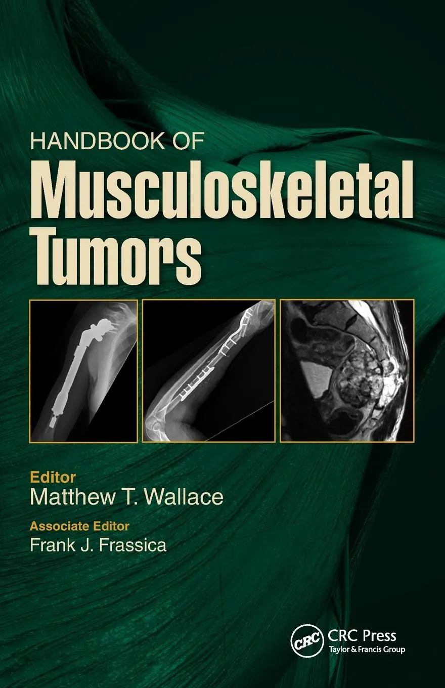 Cover: 9781630916350 | Handbook of Musculoskeletal Tumors | Matthew Wallace (u. a.) | Buch