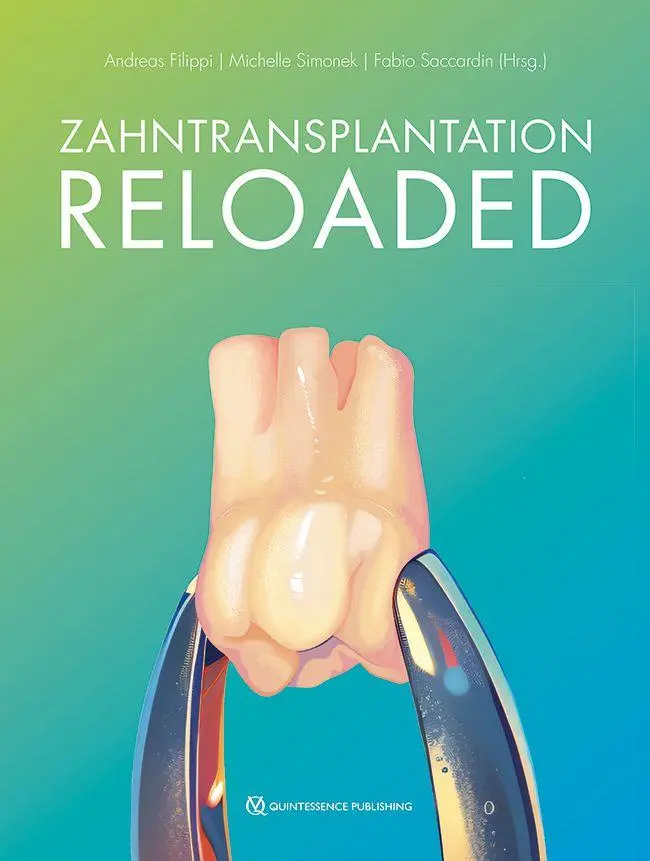 Cover: 9783868677850 | Zahntransplantation Reloaded | Andreas Filippi (u. a.) | Buch | 240 S.