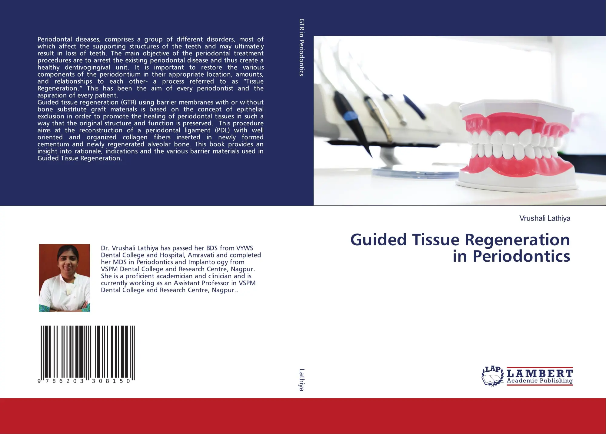 Guided Tissue Regeneration in Periodontics