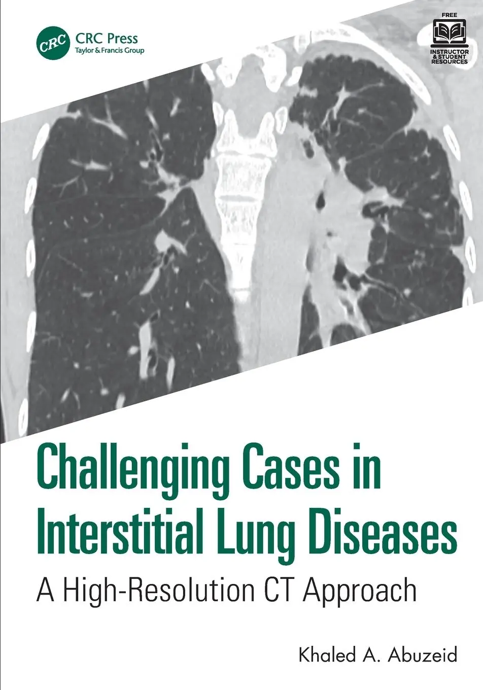 Cover: 9781032950051 | Challenging Cases in Interstitial Lung Diseases | Khaled A. Abuzeid