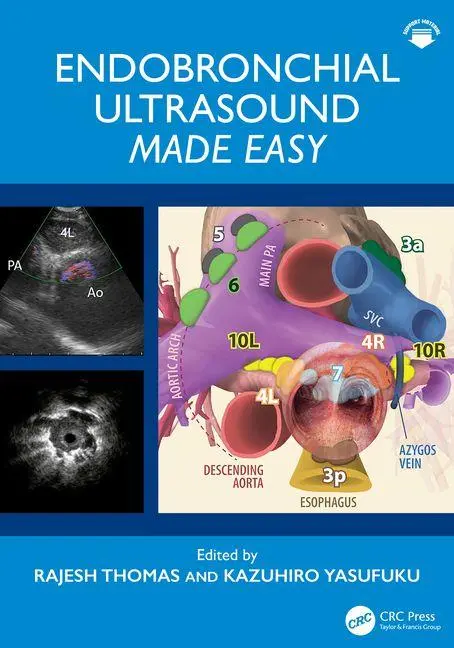 Cover: 9780367630751 | Endobronchial Ultrasound Made Easy | Kazuhiro Yasufuku (u. a.) | Buch