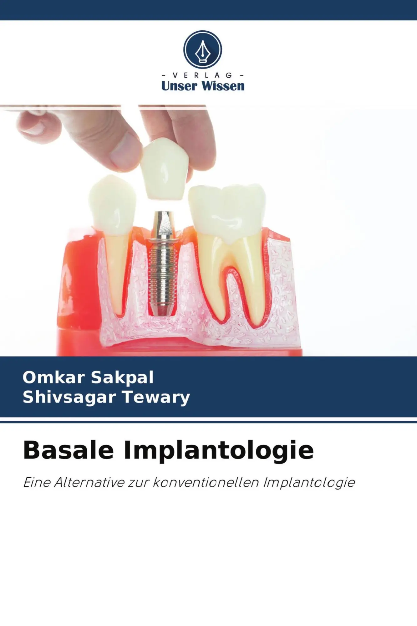 Cover: 9786202981651 | Basale Implantologie | Omkar Sakpal (u. a.) | Taschenbuch | 84 S.
