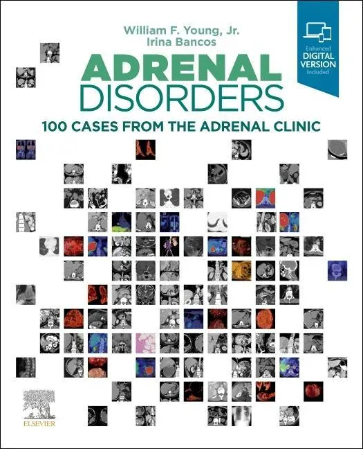 Cover: 9780323792851 | Adrenal Disorders | 100 Cases from the Adrenal Clinic | Bancos (u. a.)