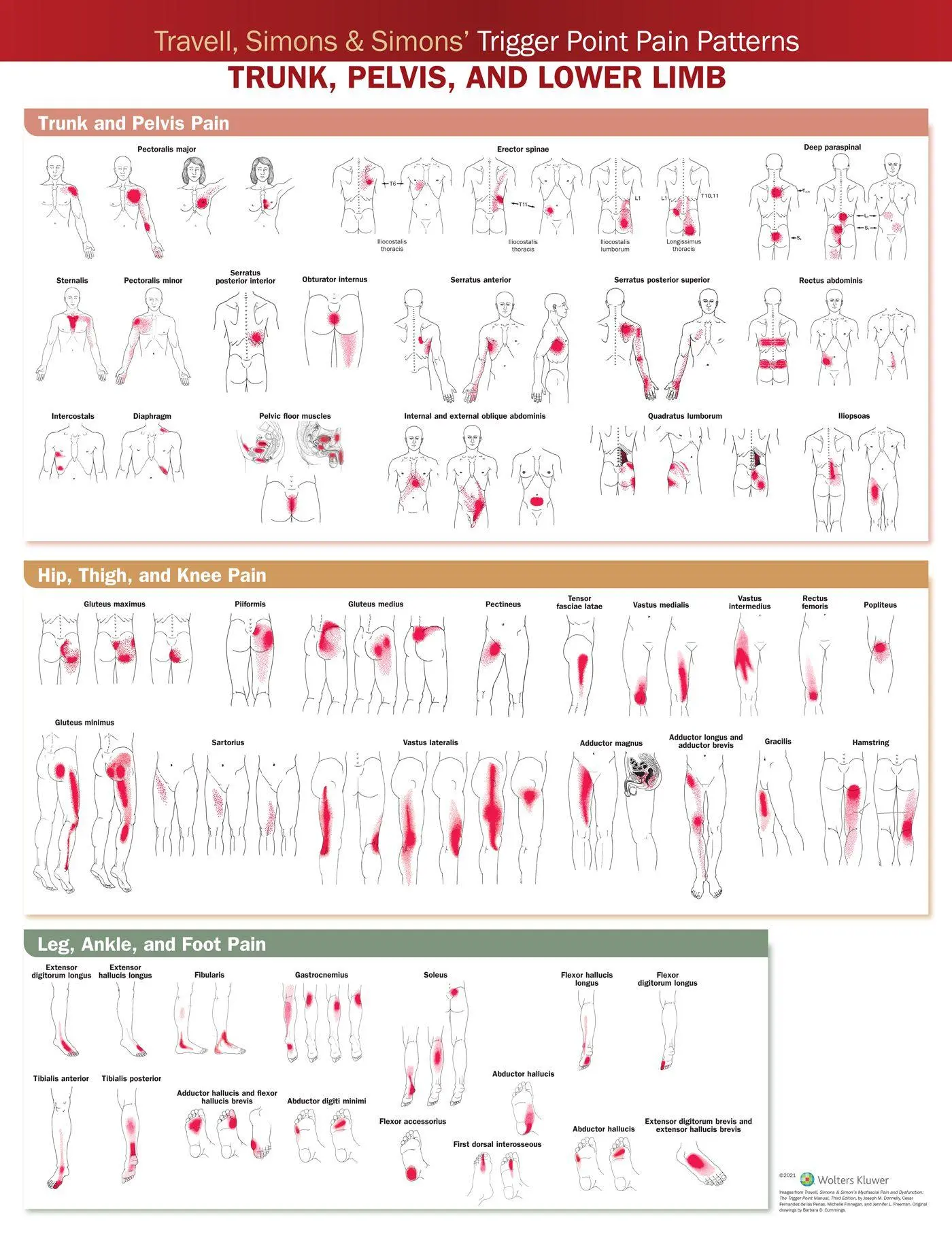 Cover: 9781975183851 | Travell, Simons &amp; Simons' Trigger Point Pain Patterns Wall Chart | Acc
