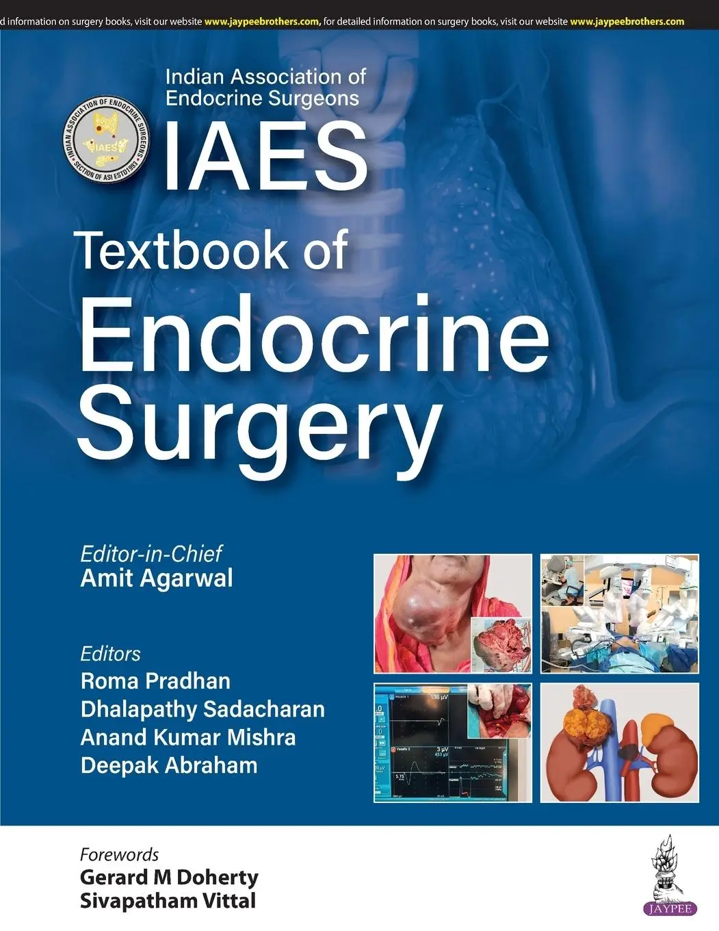 Cover: 9789390595051 | Textbook of Endocrine Surgery | Amit Agarwal (u. a.) | Taschenbuch