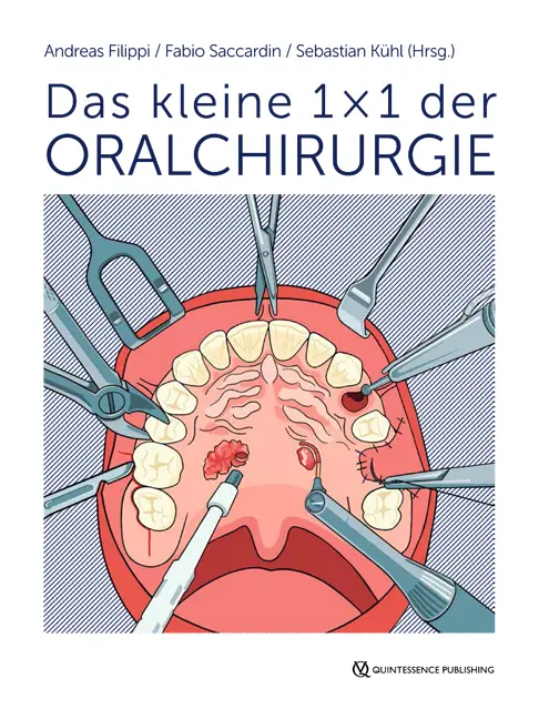 Cover: 9783868675351 | Das kleine 1 x 1 der Oralchirurgie | Andreas Filippi (u. a.) | Buch