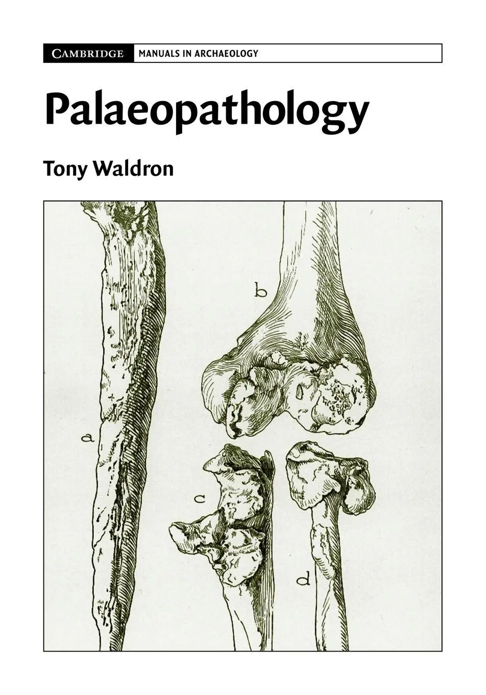 Cover: 9780521678551 | Palaeopathology | Tony Waldron | Taschenbuch | Kartoniert / Broschiert