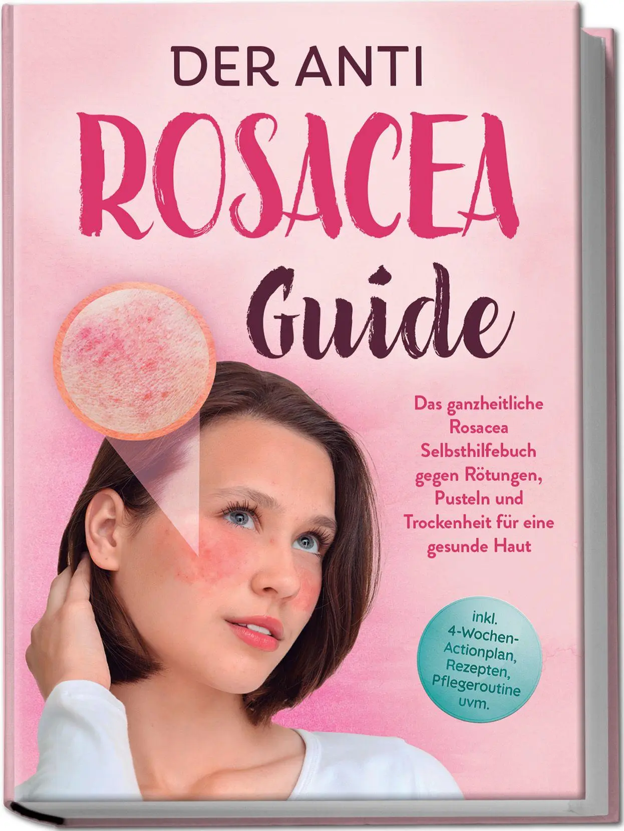 Cover: 9783757619251 | Der Anti Rosacea Guide: Das ganzheitliche Rosacea Selbsthilfebuch...