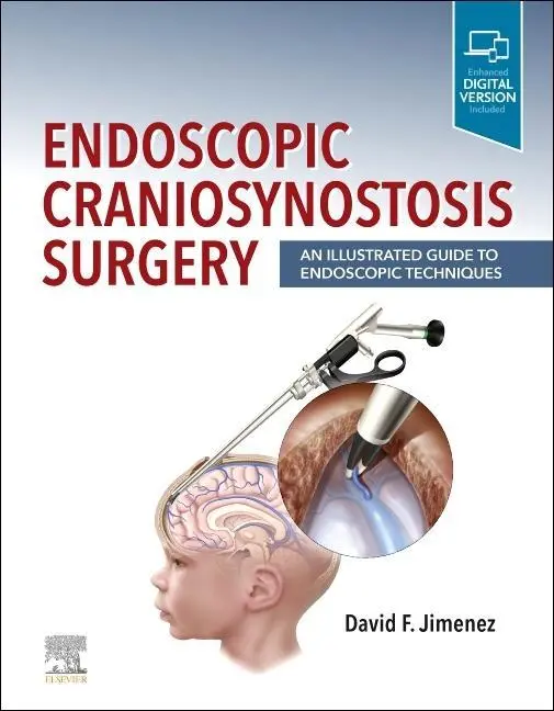 Cover: 9780323721752 | Endoscopic Craniosynostosis Surgery | David F Jimenez | Buch | 2022