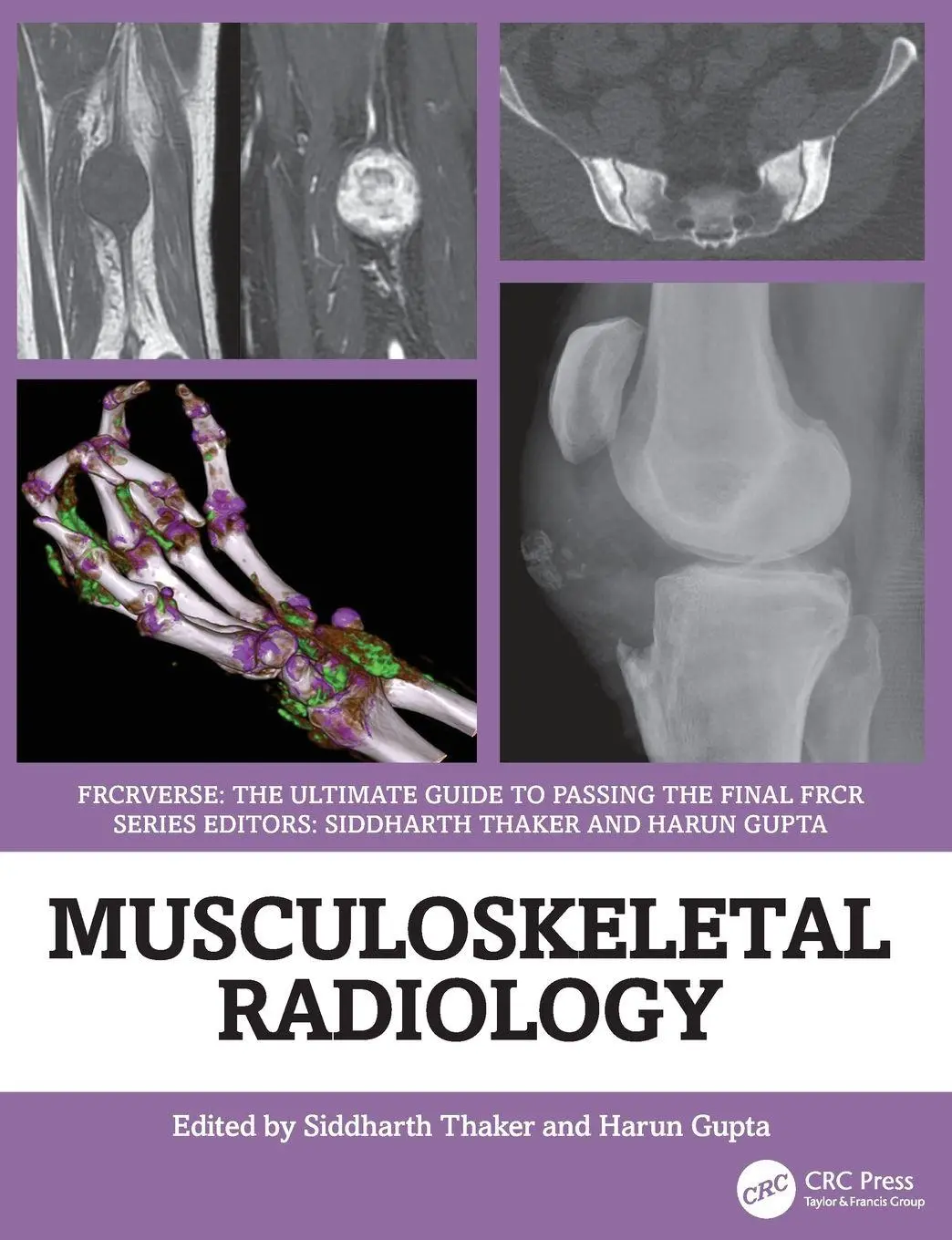 Cover: 9781032815152 | Musculoskeletal Radiology | Siddharth Thaker (u. a.) | Taschenbuch