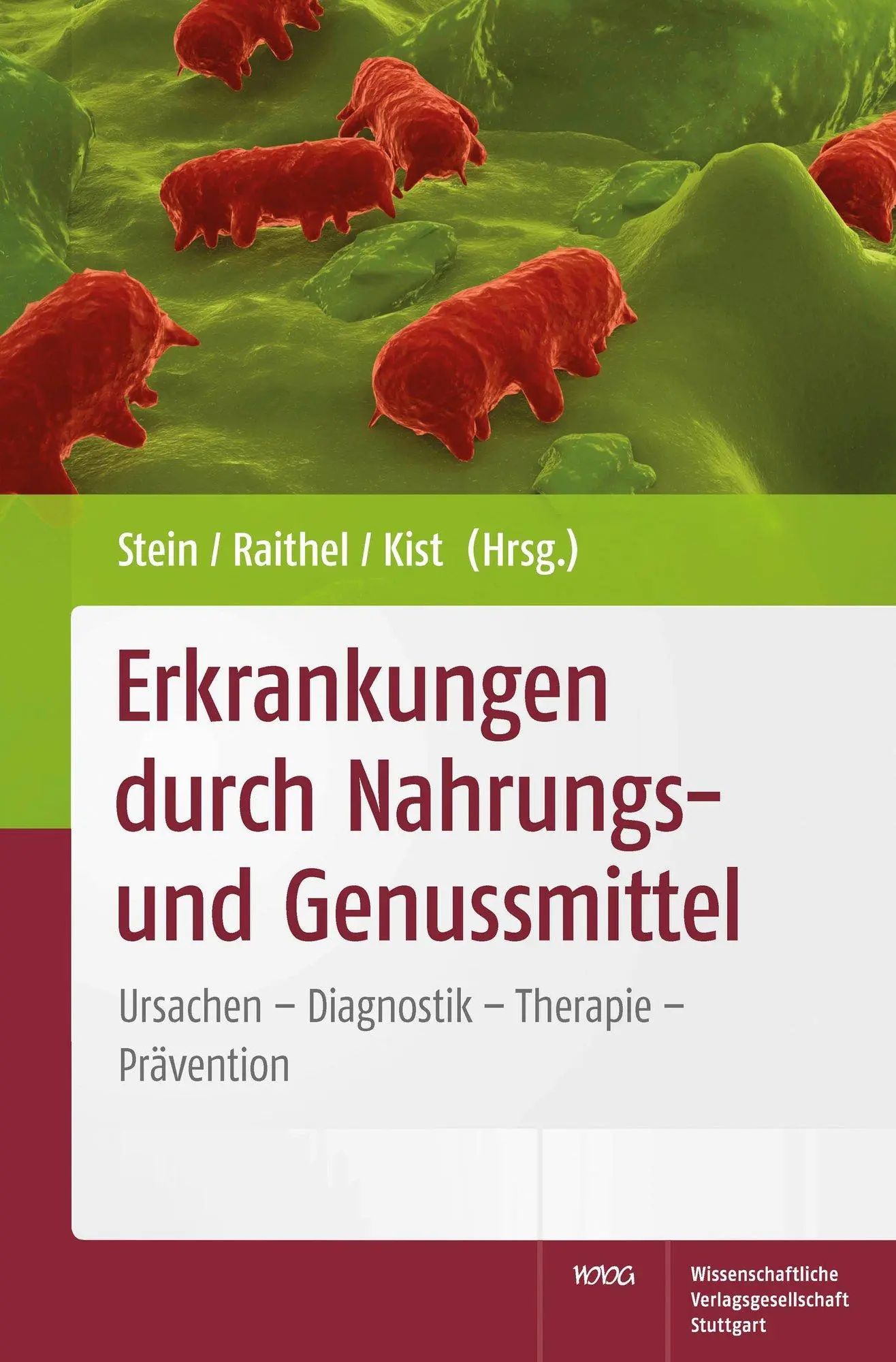 Cover: 9783804725652 | Erkrankungen durch Nahrungs- und Genussmittel | Jürgen Stein (u. a.)